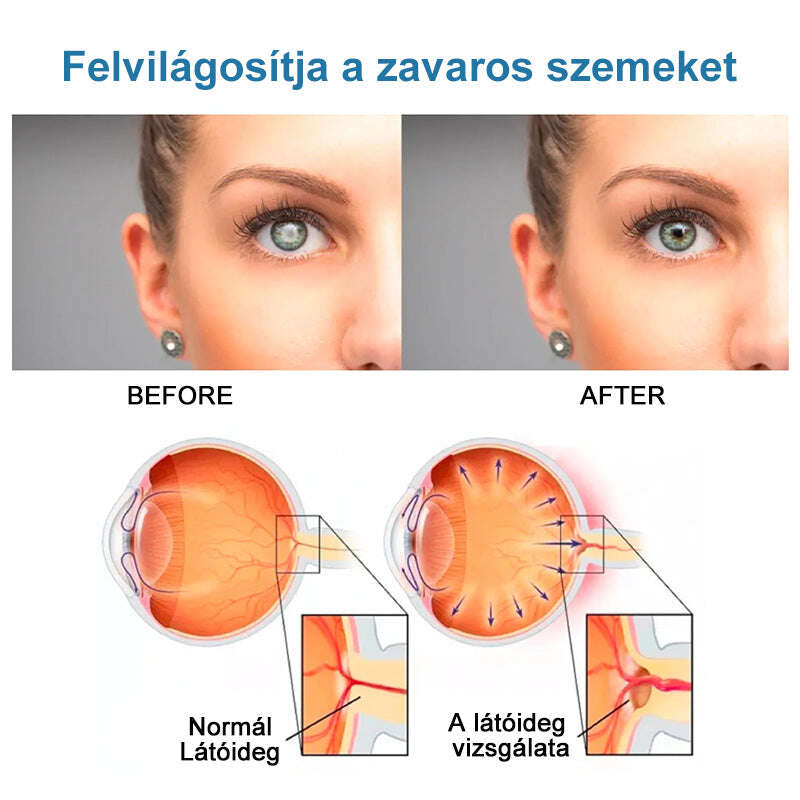 👁️Ouryard™ colírio para tratar problemas de visão