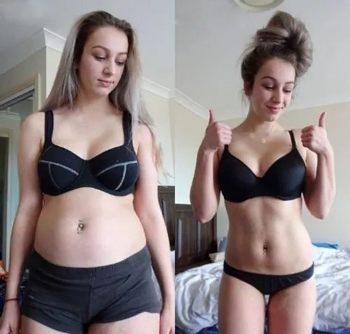 ТУРМАЛИНОВИ МЕДИЦИНСКИ ЧОРАПИ ЗА ОТСЛАБВАНЕ НА ЛИМФНИ ВЪЗЛИ AFIZ