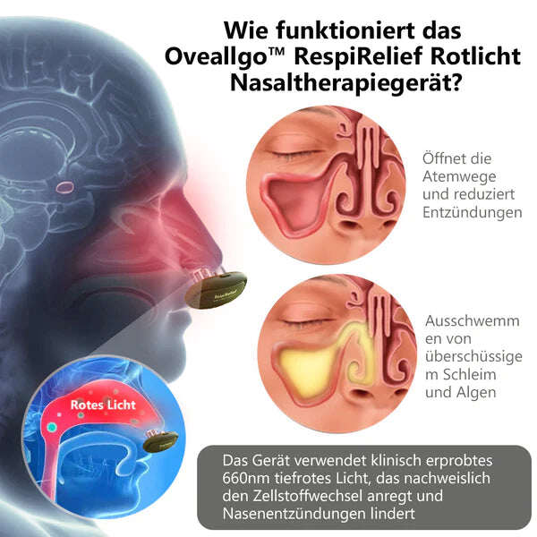 Dispositivo de terapia nasal Oveallgo™ INSTANT RespiRelief com luz vermelha