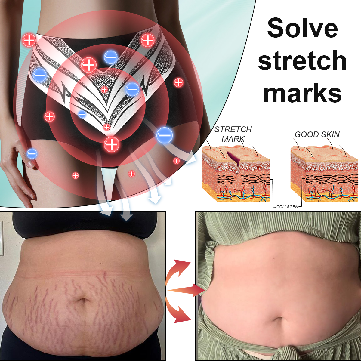 🎉 Предложение за ограничено време - Голяма отстъпка! 🔥 До 90% ОТСТЪПКА! 💰 Къси панталони с турмалиново оформящо облекло Sfrcord™ от титанови влакна✅✅