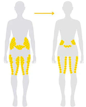 Fivfivgo™ ултразвукова гривна за изгаряне на мазнини и детоксикация