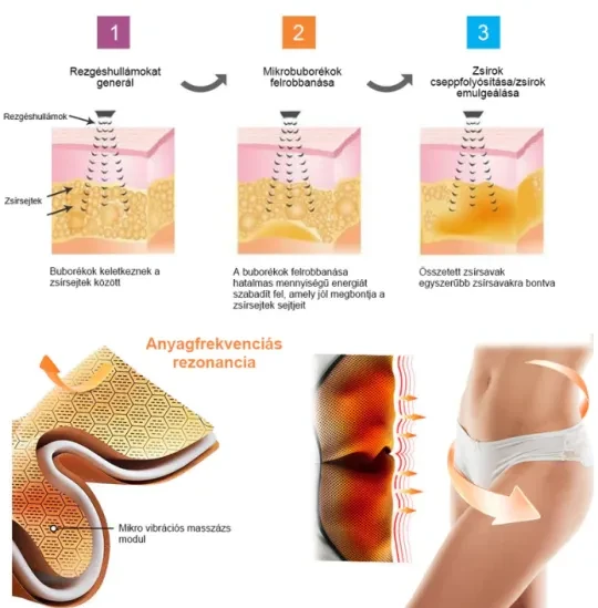 [S-6XL]LuckySong® Calções de seda com módulo de massagem microvibrante com rejuvenescimento e modelação de fibras ionizadas🌻