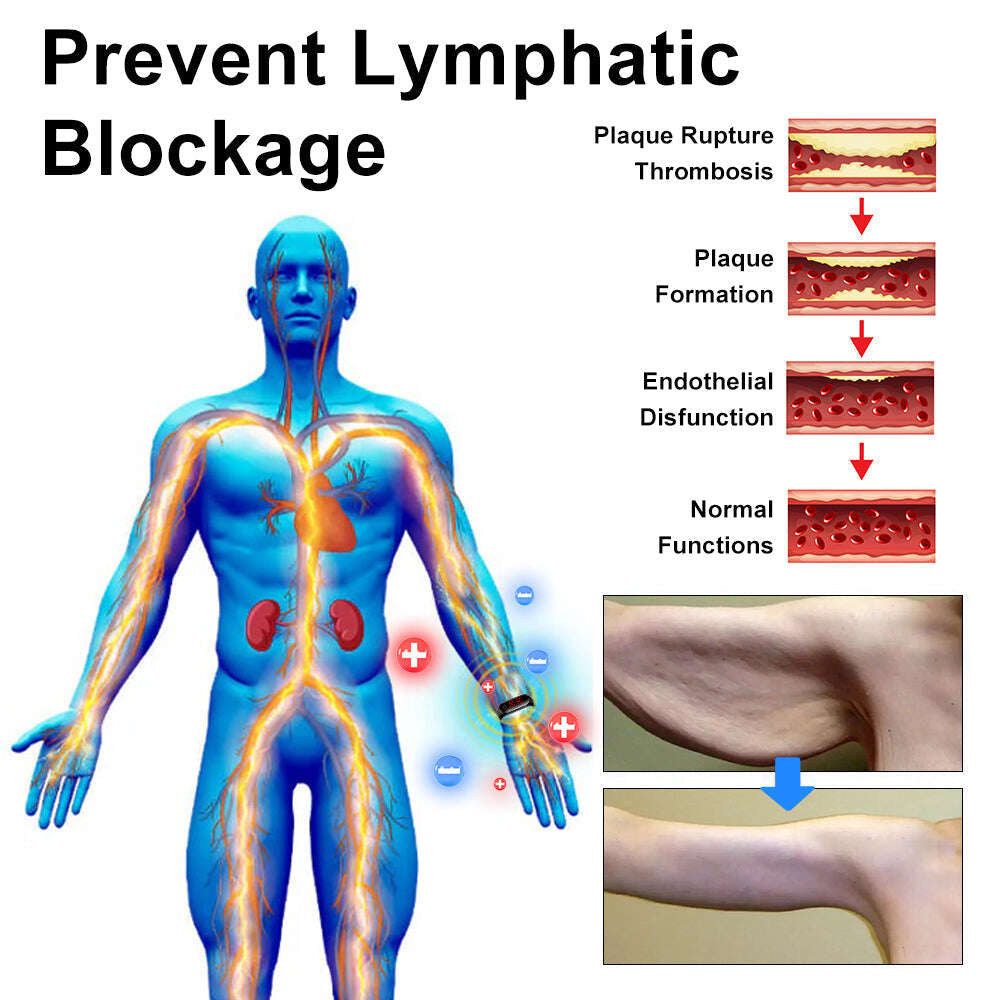 Fivfivgo™ Ултразвукова гривна за премахване на мазнините и детоксикация - енергиен баланс