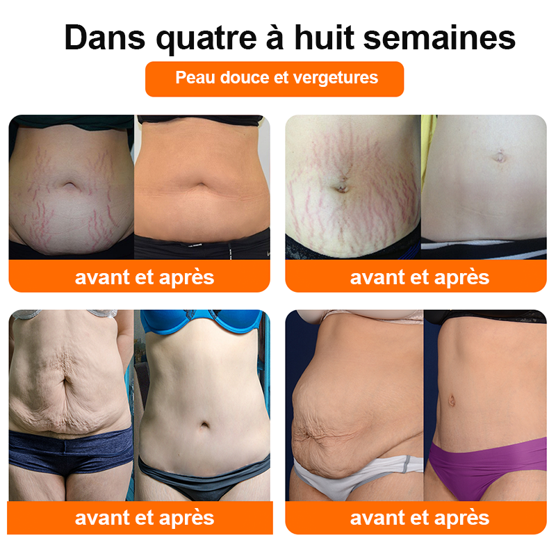 👑👑𝐵𝑎𝑖𝑐𝑙𝑜𝑢𝑑™ Nova versão Tecnologia 5D 2024 Authentic Ice Sense Bee Venom Fibra Iônica Reparo Corporal [último dia por tempo limitado 70% OFF]