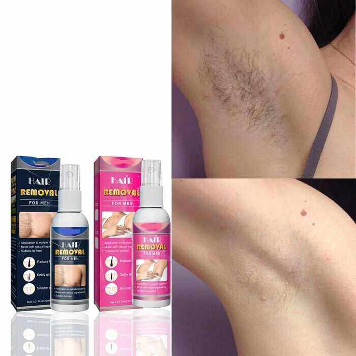 🔥Grande promoção 🔥Spray corporal depilatório