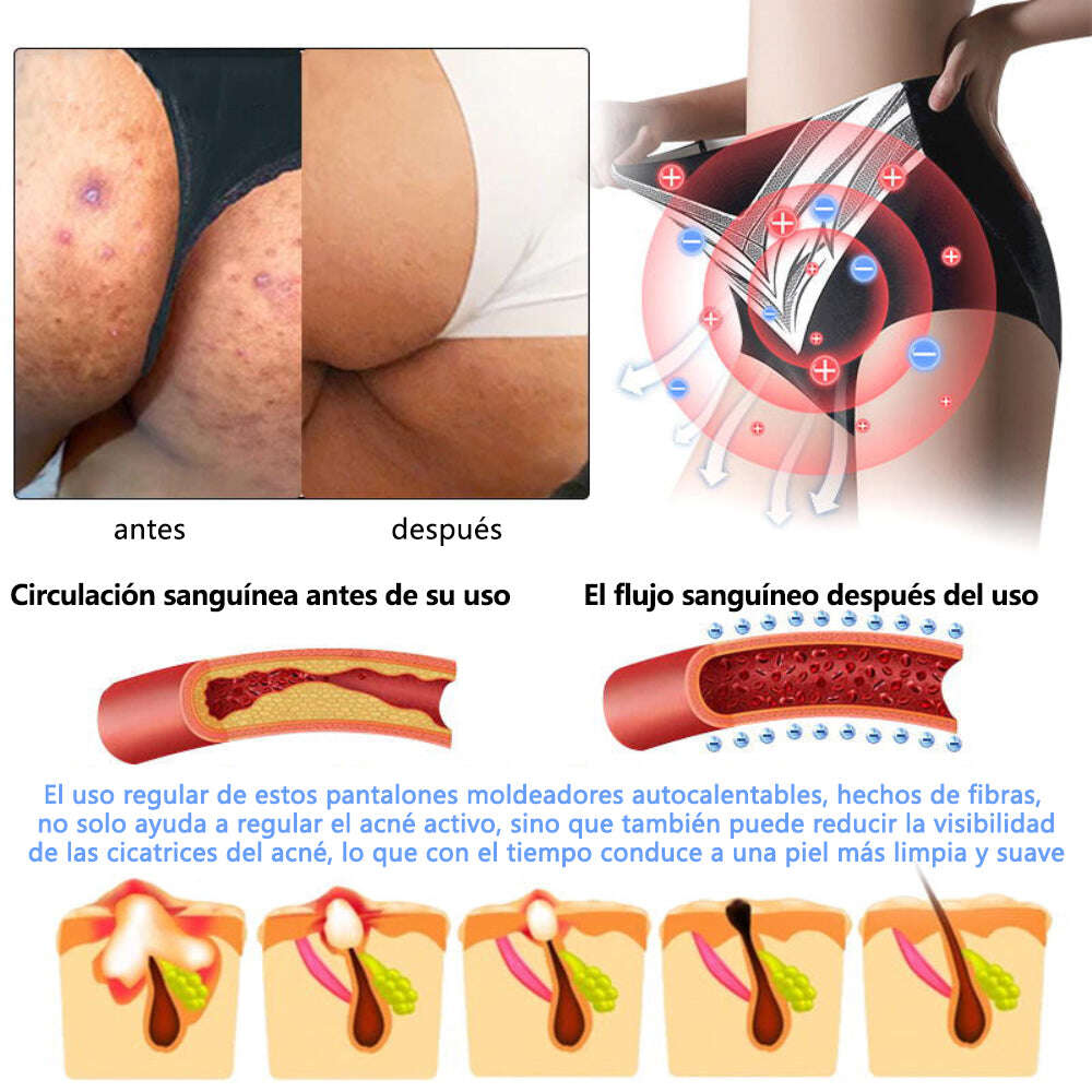 🎉 Oferta por tempo limitado – Grande desconto! 💰 Calções modeladores Anyidea™ de turmalina autorregulada com fibra de titânio