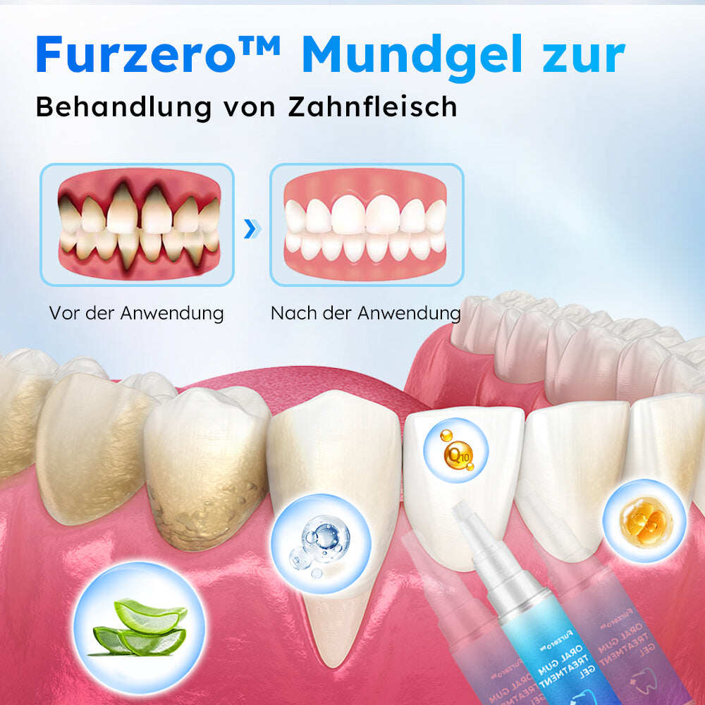 Furzero™ Żel doustny do leczenia dziąseł