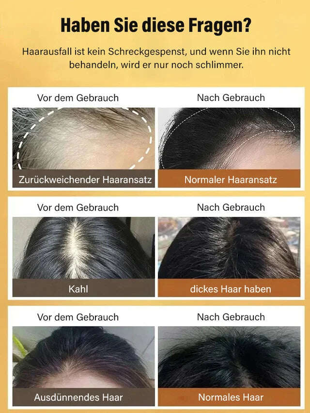 Шампоан против косопад