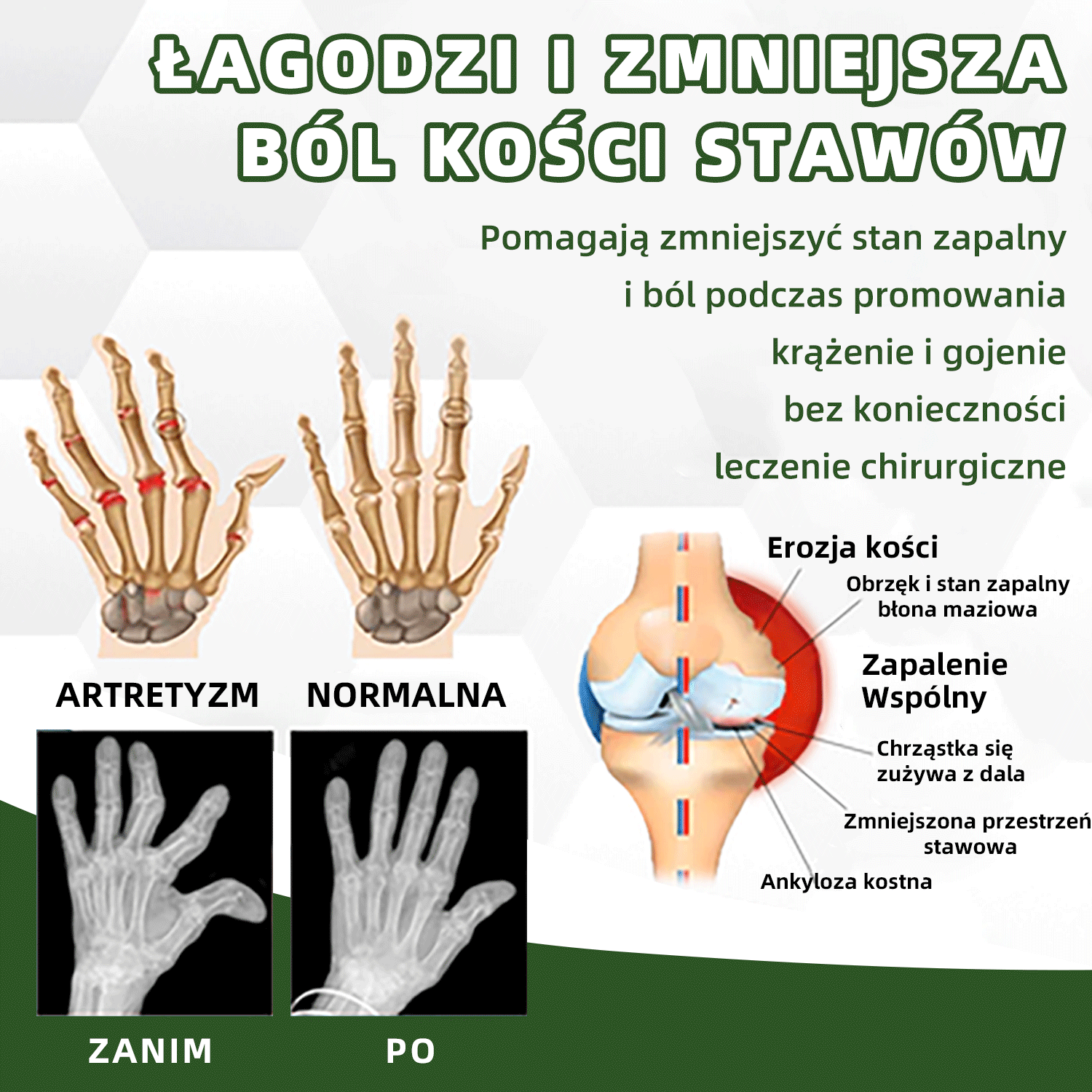 🚩🚩 Creme Australian Honey Bee Truison Cvreoz ™ para controle da dor e cura óssea (🐝 Desconto por tempo limitado nos últimos 30 minutos 💥）