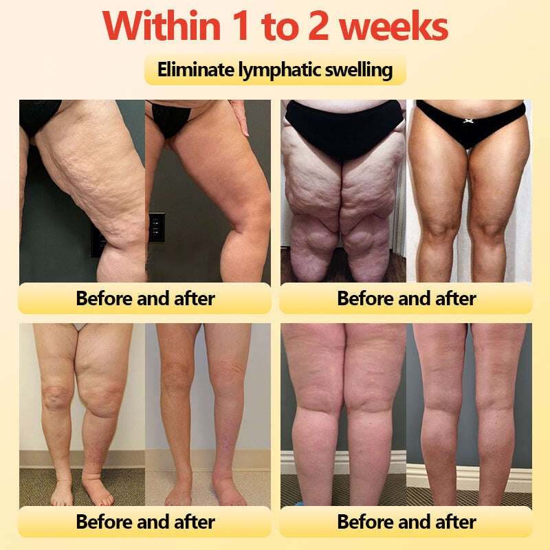 Últimas 3 horas: 80% DE DESCONTO 🔥 Shorts modeladores de turmalina autoaquecidos em fibra de titânio Neslemy™