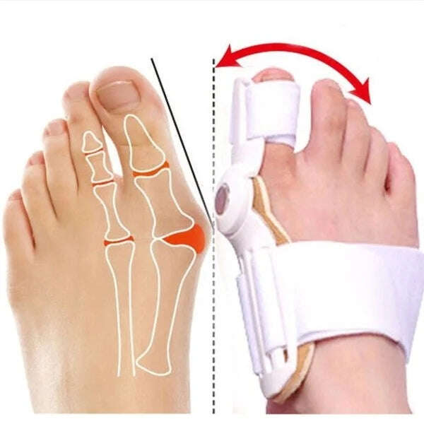 【Doctor recommended】Bunion Corrector para homens e mulheres