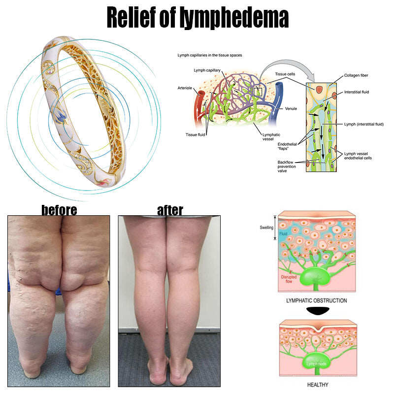 LOVILDS™𝐆𝐨𝐥𝐝 𝐂𝐥𝐨𝐢𝐬𝐨𝐧𝐧é 𝐄𝐧𝐚𝐦𝐞𝐥 𝐁𝐫𝐚𝐜𝐞𝐥𝐞𝐭 🔥 𝐋𝐲𝐦𝐩𝐡𝐚𝐭𝐢𝐜 𝐌𝐚𝐠𝐧𝐞𝐭𝐢𝐜 𝐓𝐡𝐞𝐫𝐚𝐩𝐲💎