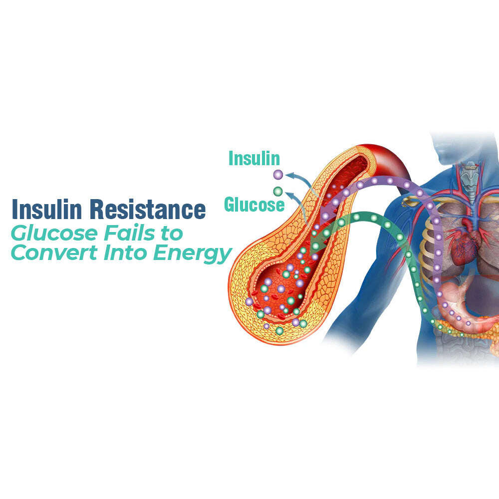 GFOUK™️ Устройство за балансиране на електрически импулс SucroseGuard