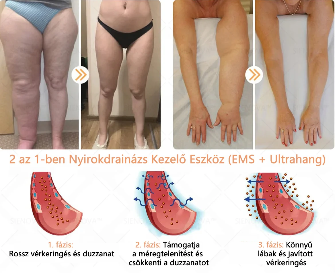 SIENOVATM💎 Dispositivo portátil para drenagem linfática e relaxamento articular👨‍⚕️ Terapia 2 em 1 original