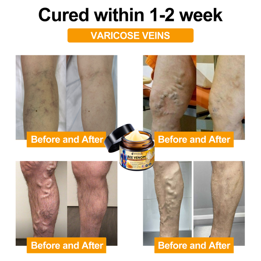 Fivfivgo™ Bee Venom Instant Ultra Strength Pain Relief Therapy Cream (Elimina a dor para artrite, dores musculares, nas costas, joelhos, costas, ombros, quadris, pulsos, mãos)