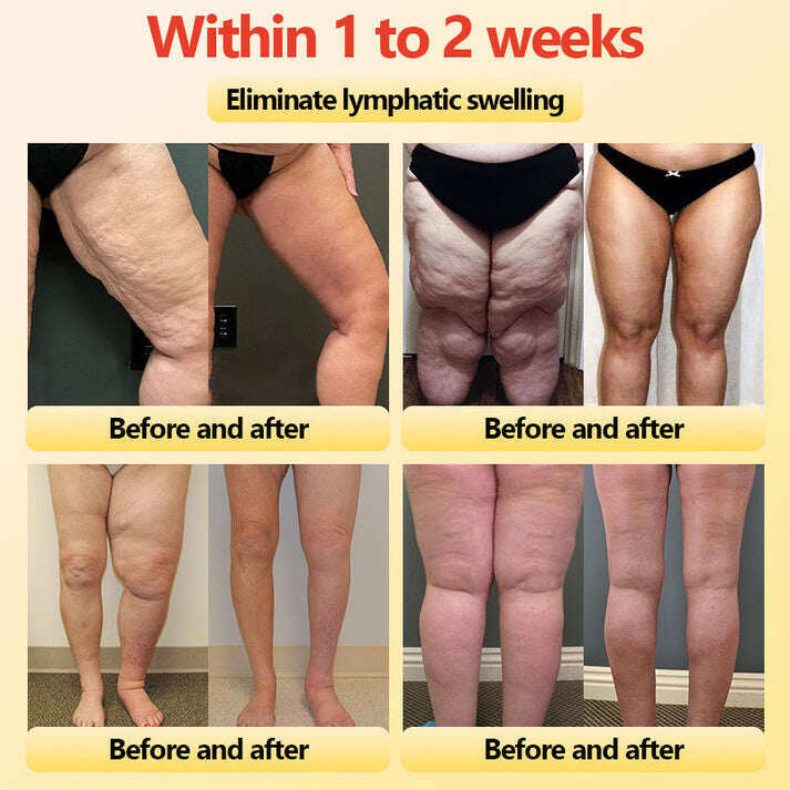 🎉 Предложение за ограничено време - Голяма отстъпка! 🔥 До 90% ОТСТЪПКА! 💰 Къси панталони с турмалиново оформящо облекло Sfrcord™ от титанови влакна✅✅