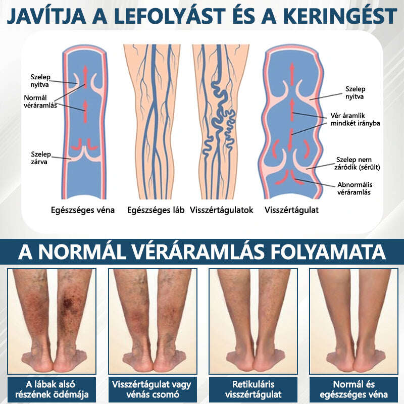 Cvreoz® Fekete kömény Ödéma méregtelenítő gyógynövénykrém💙