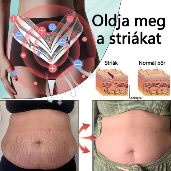 Sfrcord™ titánszálas önmelegedő turmalin formázó rövidnadrág