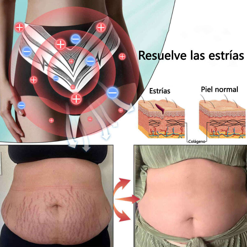 🎉 Oferta por tempo limitado – Grande desconto! 💰 Calções modeladores Anyidea™ de turmalina autorregulada com fibra de titânio