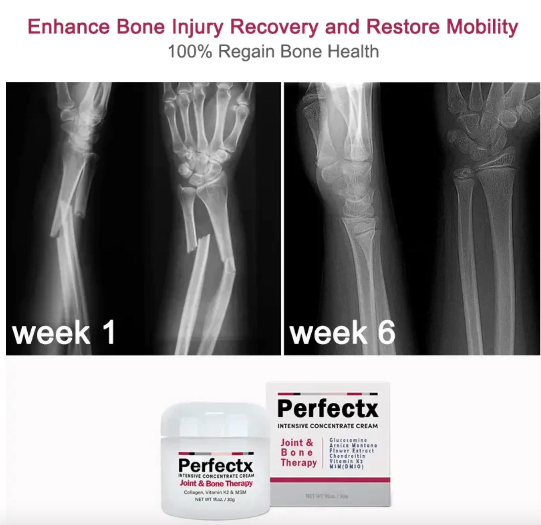GFOUK™ PERFECTX JOINT AND BONE HEALING CREAM