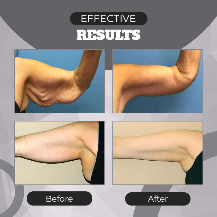 Bracelete de Drenagem Linfática de Terapia Magnética