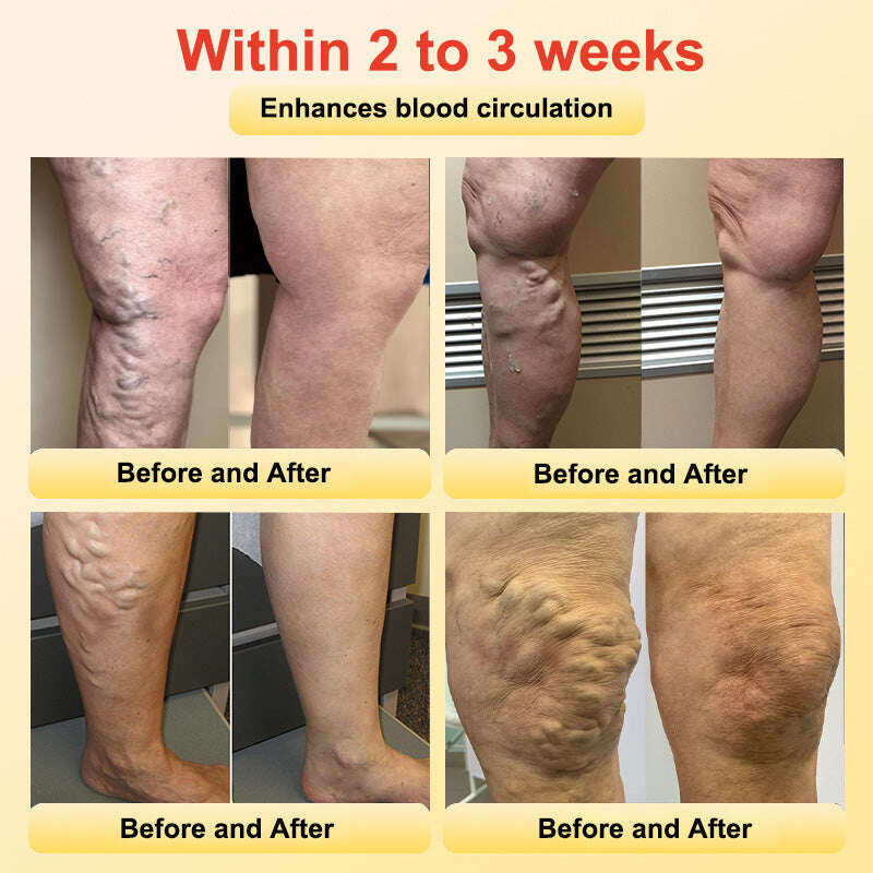 Гривна за здраве CZTICLE™ (ограничена във времето отстъпка🔥 последен ден)