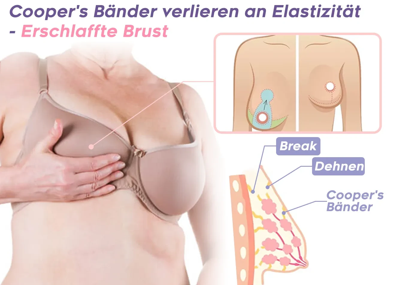 GFOUK™️ Massageador elétrico de busto BlossomUp