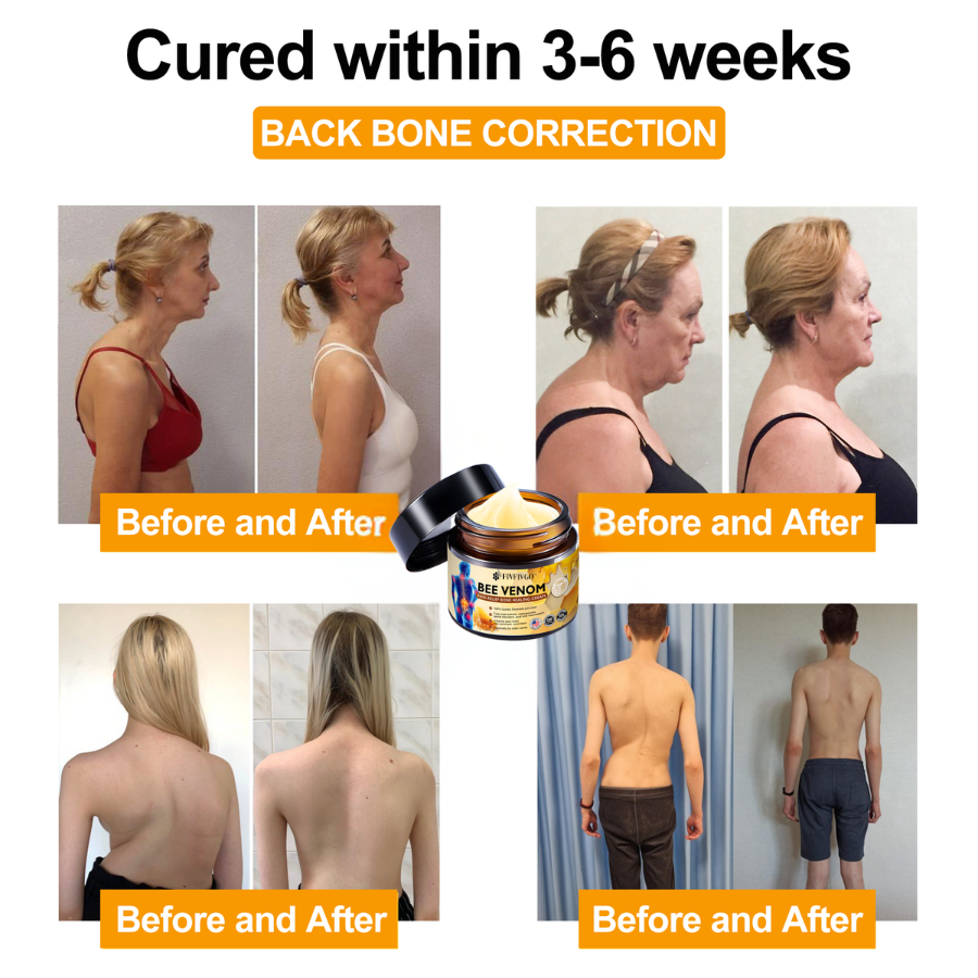 Fivfivgo™ Bee Venom Instant Ultra Strength Pain Relief Therapy Cream (Elimina a dor para artrite, dores musculares, nas costas, joelhos, costas, ombros, quadris, pulsos, mãos)