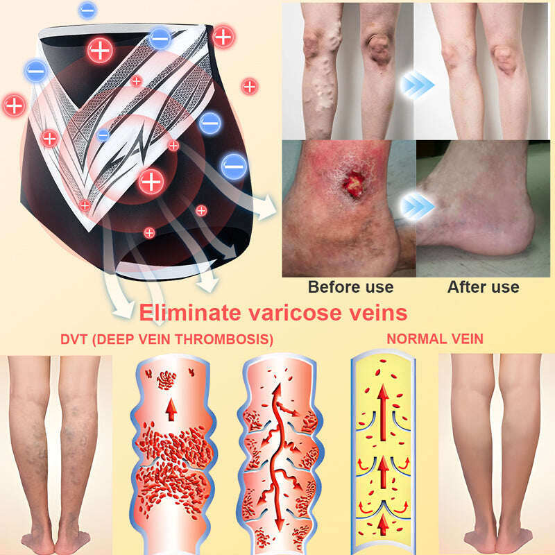 【ILF R&D】PaURAJU™ Магнитни турмалинови оформящи шорти ❤️ Голяма новогодишна разпродажба 40%