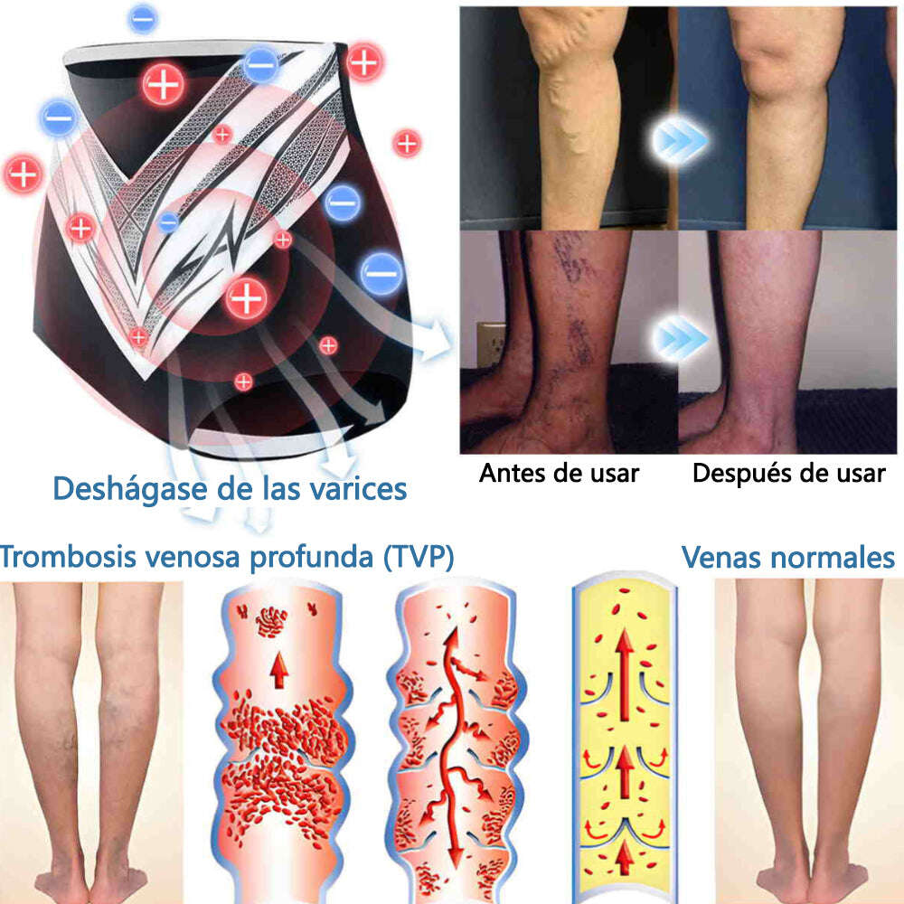🎉 Oferta por tempo limitado – Grande desconto! 💰 Calções modeladores Anyidea™ de turmalina autorregulada com fibra de titânio