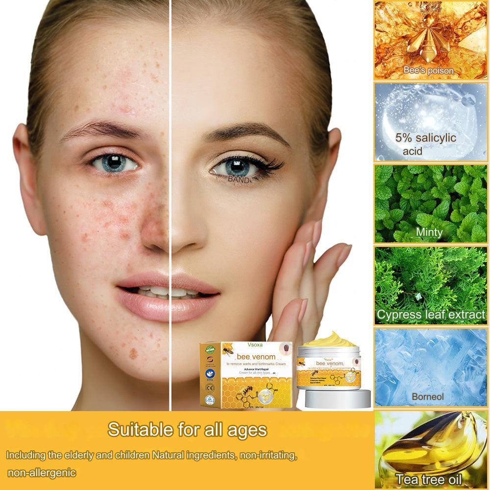 🛒❤Creme para remoção de veneno de abelha Vsoxoxa™ (👨‍⚕AD RECOMMEND)🐝🐝(🔥Evento promocional no último dia 50% 💥💥)🔥💥