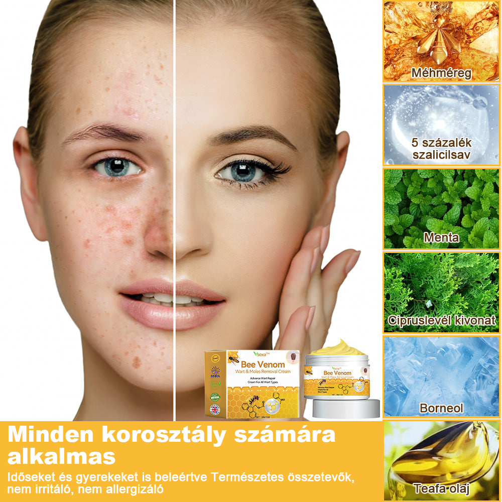 Creme para remoção de verrugas e verrugas com veneno de abelha Vsoxa™ (venda no último dia, 80% de desconto)