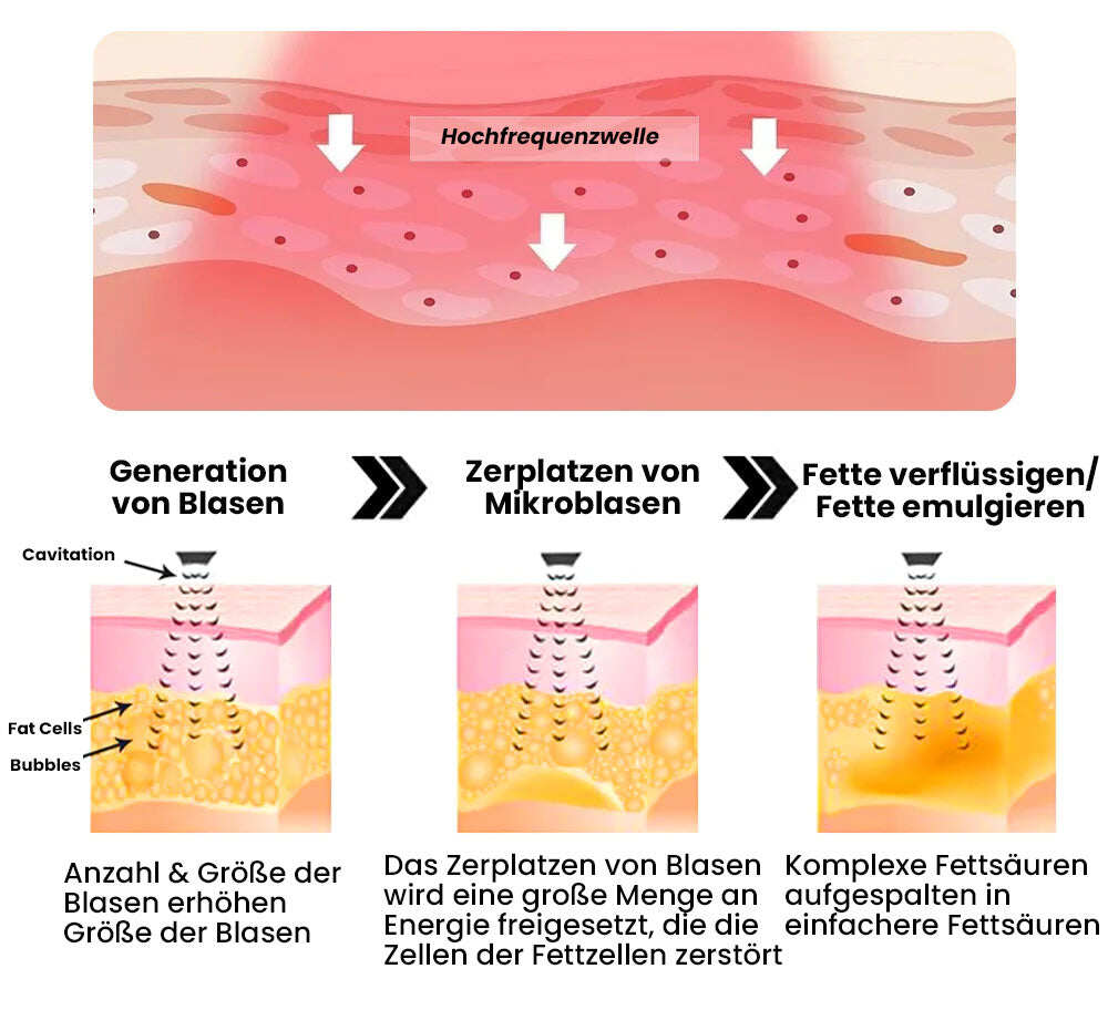 Oveallgo™ ToneX banda profissional challhäufigkeit para a modelação do corpo.