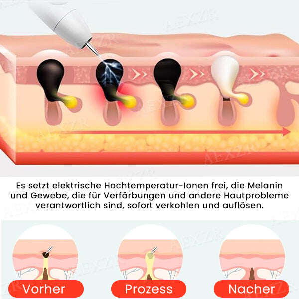 Caneta laser portátil para cuidados com a pele Fivfivgo™