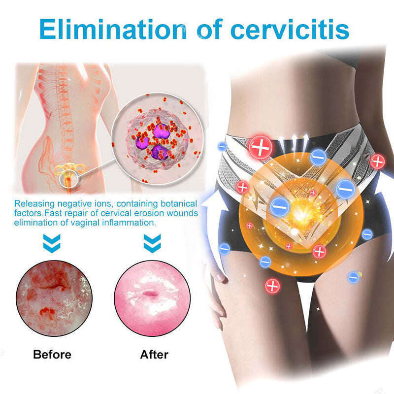 Últimas 3 horas: 80% DE DESCONTO 🔥 Shorts modeladores de turmalina autoaquecidos em fibra de titânio Neslemy™