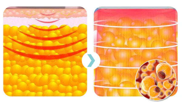 Fivfivgo™ ултразвукова гривна за изгаряне на мазнини и детоксикация