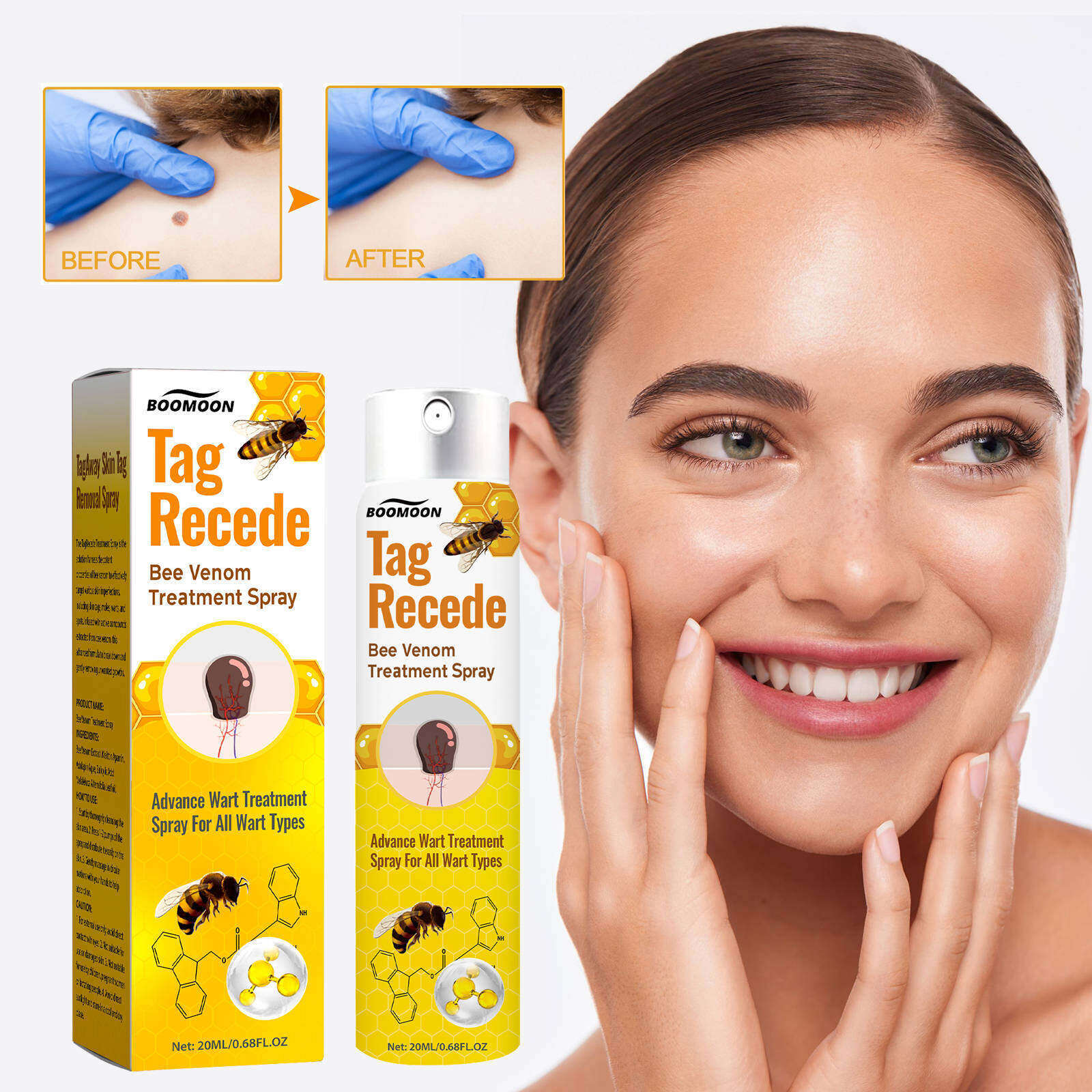 🧡 Spray Cvreoz com veneno de abelha para remover verrugas e manchas (👨‍⚕DAA RECOMENDA)🐝🐝(🔥Oferta de último dia com 50% de desconto