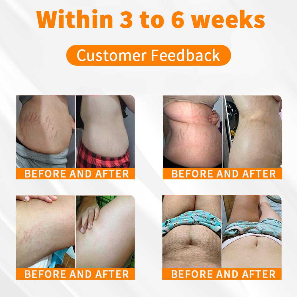 𝐏𝐄𝐀𝐑𝐋𝐌𝐎𝐎𝐍™ Микровибрационен масажен модул – Ремонт на оформящо облекло 🏆🔥 (⏰Ограничена отстъпка за последните 30 минути⏰)