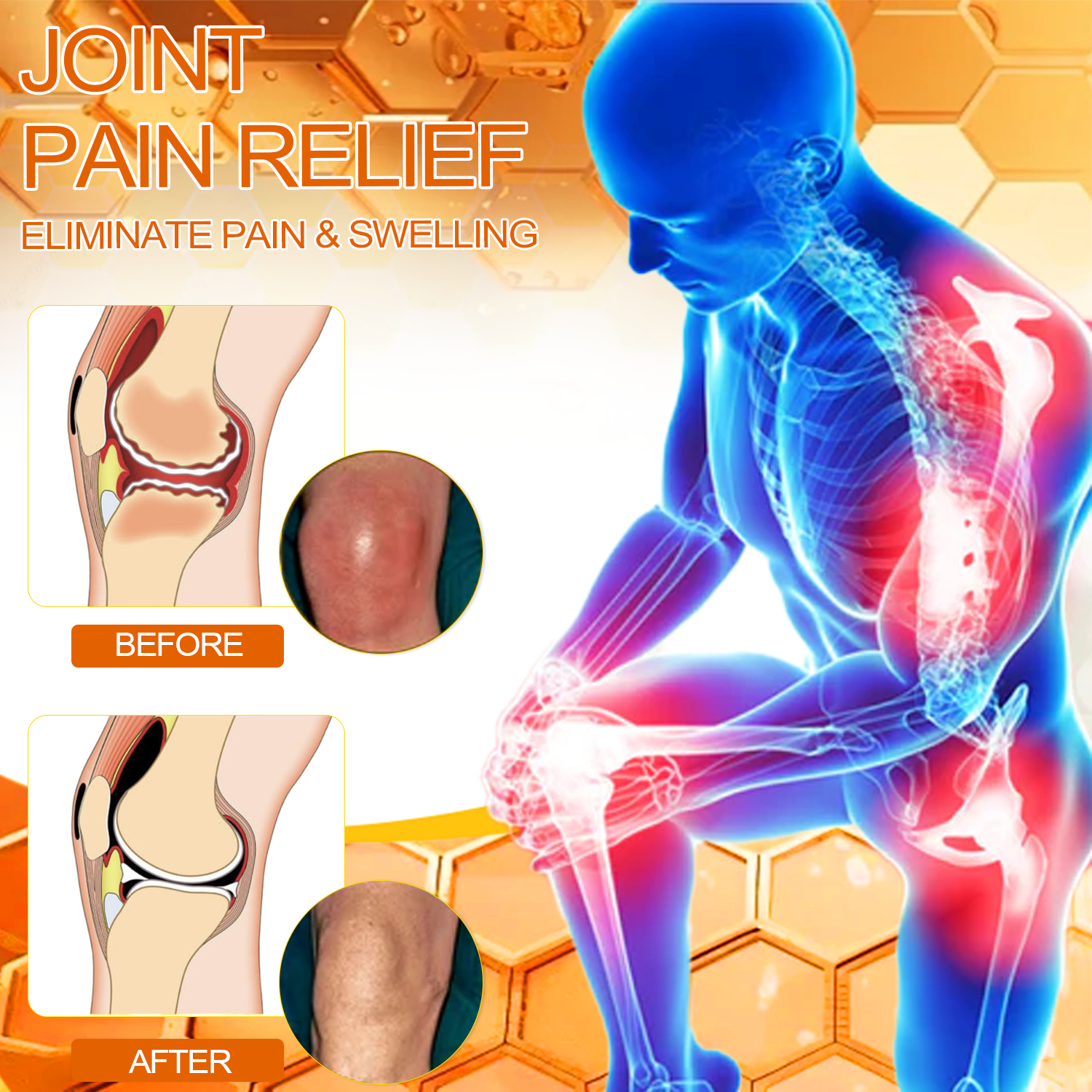 Fivfivgo™ Bee Venom Instant Ultra Strength Pain Relief Therapy Cream (Elimina a dor para artrite, dores musculares, nas costas, joelhos, costas, ombros, quadris, pulsos, mãos)