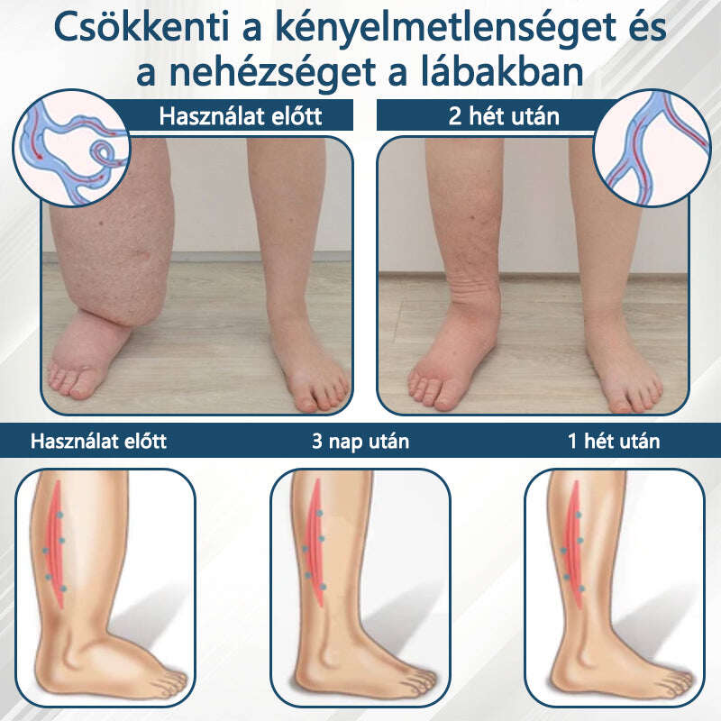 Cvreoz® Fekete kömény Ödéma méregtelenítő gyógynövénykrém💙